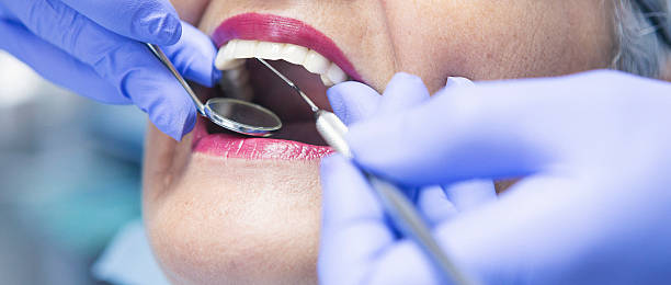 Best Emergency Dental Care for Broken or Chipped Teeth in Highland, CA